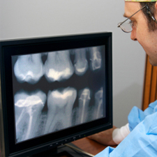 Dentist reviewing an xray of teeth